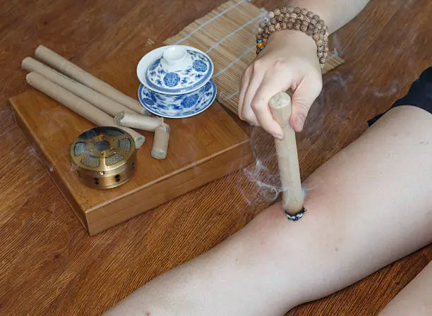 Moxa-hoito akupisteiden lämmittämiseen hoidon aikana.
